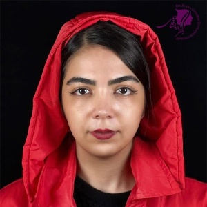 rhinoplasty-391