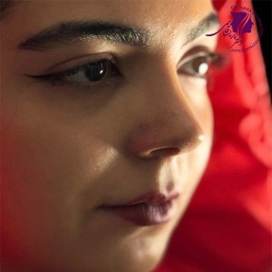 rhinoplasty-393