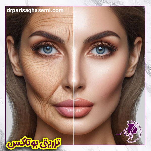 تزریق بوتاکس - دکتر پریسا قاسمی