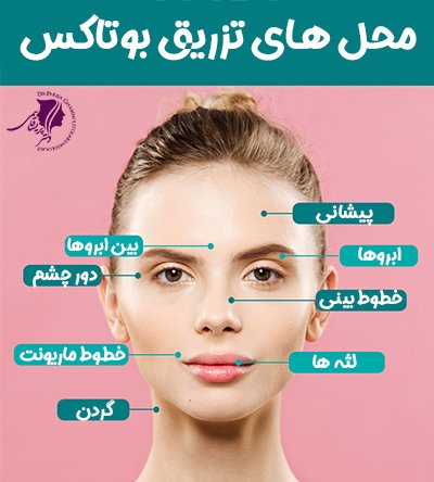 بوتاکس به کجا تزریق می شود؟