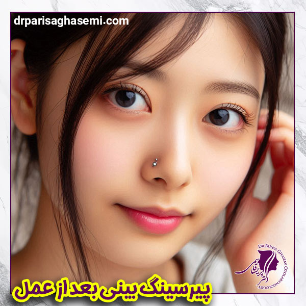پیرسینگ بعد از عمل بینی - دکتر قاسمی
