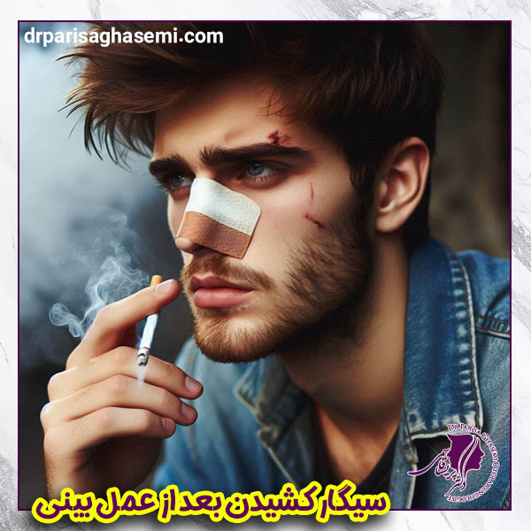 سیگار بعد از عمل بینی - دکتر پریسا قاسمی