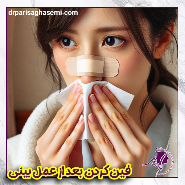 فین کردن بعد از عمل بینی - دکتر پریسا قاسمی
