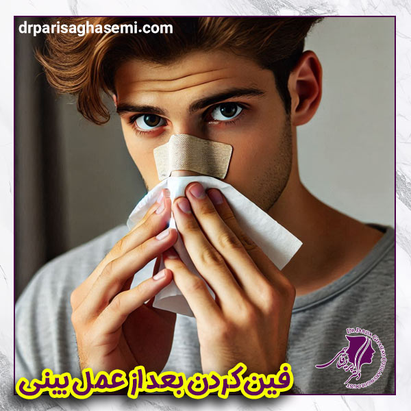 فین کردن بعد از عمل بینی - دکتر پریسا قاسمی