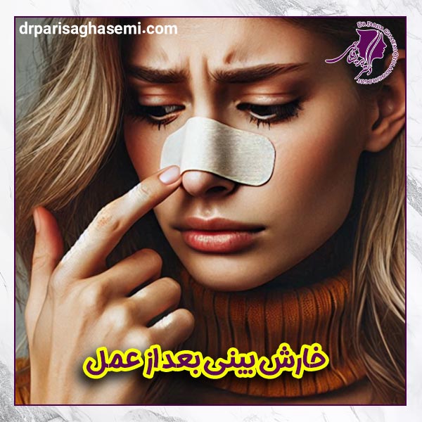 خارش بینی بعد از عمل | دکتر قاسمی