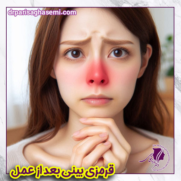 قرمزی بینی بعد از عمل - دکتر پریسا قاسمی