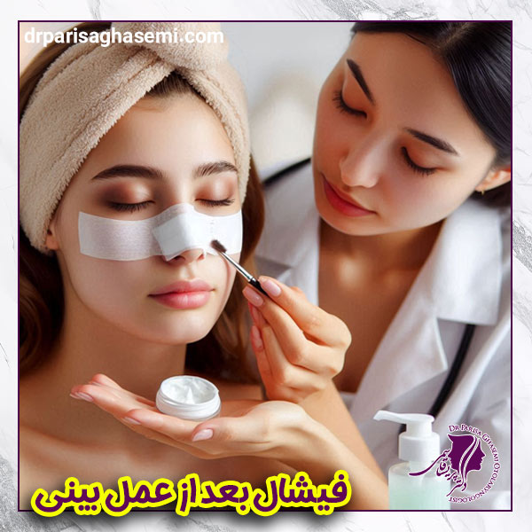 فیشال بعد از عمل بینی | دکتر پریسا قاسمی