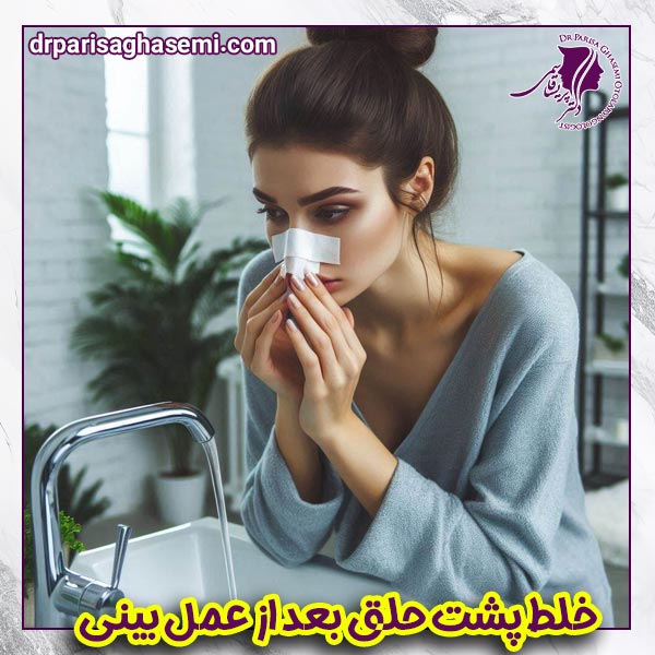 خلط پشت حلق بعد از عمل بینی - دکتر پریسا قاسمی 