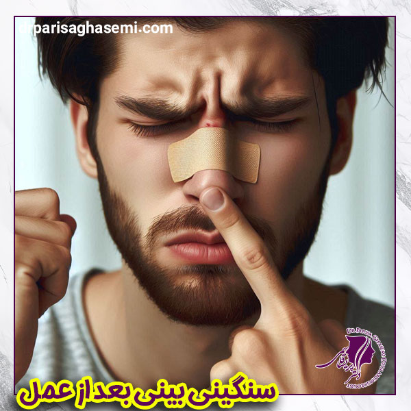 سنگینی بینی بعد از عمل بینی - دکتر قاسمی