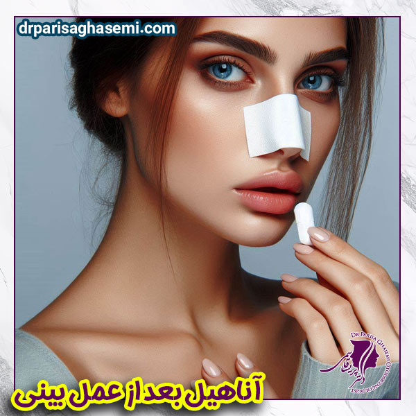  آناهیل بعد از عمل بینی - دکتر قاسمی 