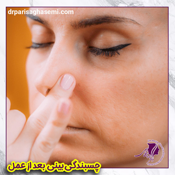 چسبندگی بینی بعد از عمل | دکتر قاسمی