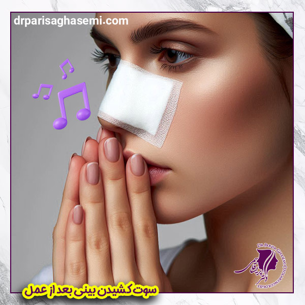 سوت کشیدن بینی بعد از عمل - دکتر پریسا قاسمی