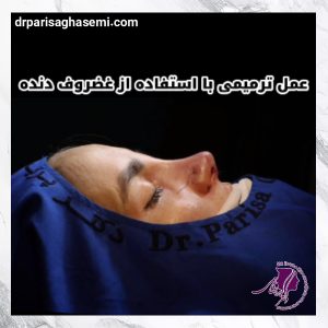 عمل بینی ترمیمی - دکتر پریسا قاسمی