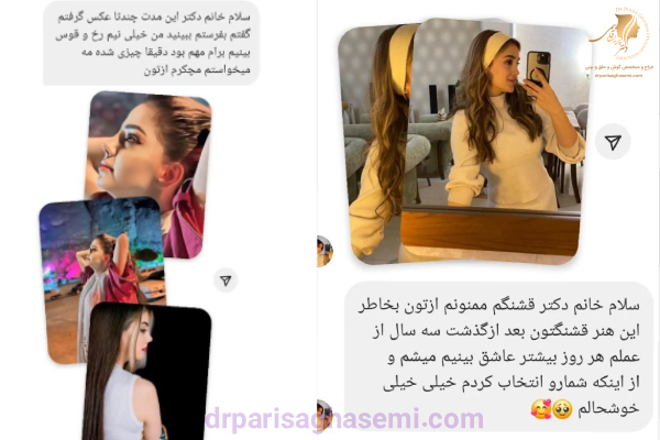 نظرات و رضایت از بهترین جراح بینی تهران - دکتر قاسمی