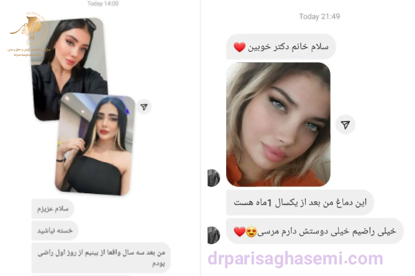 نظرات و رضایت از بهترین جراح بینی تهران - دکتر قاسمی