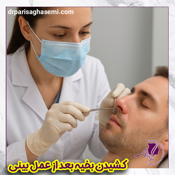 کشیدن بخیه بعد از عمل بینی - دکتر قاسمی