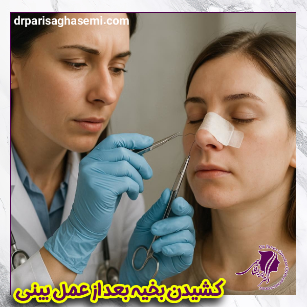 کشیدن بخیه بعد از عمل بینی - دکتر قاسمی 