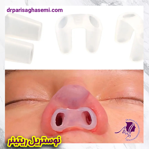 نوستریل ریتینر - دکتر پریسا قاسمی